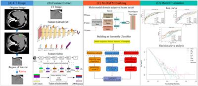 Enhancing preoperative diagnosis of microvascular invasion in hepatocellular carcinoma: domain-adaptation fusion of multi-phase CT images